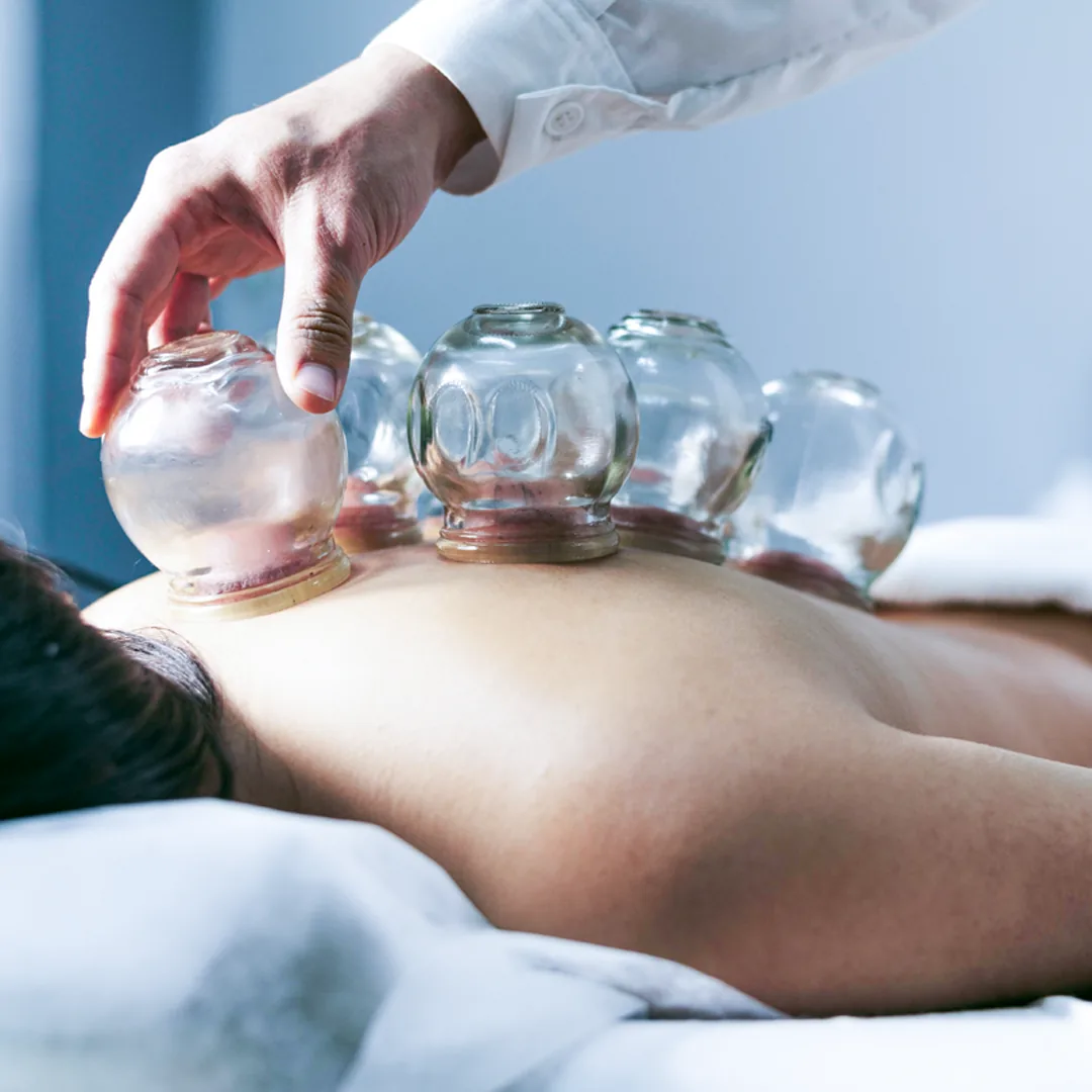 Treatment Cupping