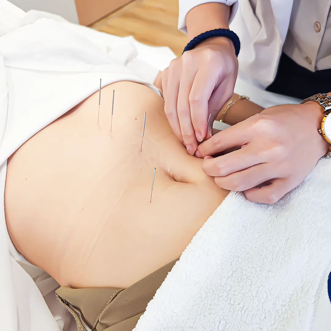 Treatment Slimming Acu